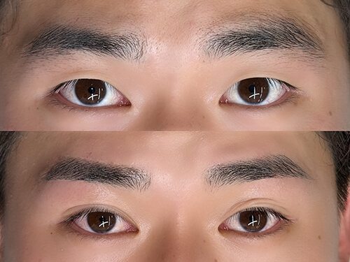 メンズ眉毛ワックス